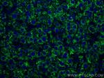 PPP4R1 Antibody in Immunohistochemistry (Paraffin) (IHC (P))