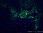 ERO1L Antibody in Immunohistochemistry (Paraffin) (IHC (P))