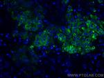 ERO1L Antibody in Immunohistochemistry (Paraffin) (IHC (P))