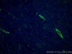 TTPA Antibody in Immunohistochemistry (Paraffin) (IHC (P))