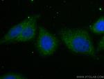PPM1D Antibody in Immunocytochemistry (ICC/IF)