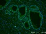 TAOK3 Antibody in Immunohistochemistry (Paraffin) (IHC (P))