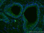 TAOK3 Antibody in Immunohistochemistry (Paraffin) (IHC (P))
