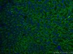 Arfaptin-1 Antibody in Immunohistochemistry (Paraffin) (IHC (P))