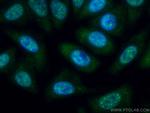 SF3B3 Antibody in Immunocytochemistry (ICC/IF)