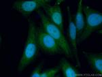 MGMT Antibody in Immunocytochemistry (ICC/IF)