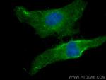 BSEP Antibody in Immunocytochemistry (ICC/IF)
