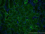 SLC2A9 Antibody in Immunohistochemistry (Paraffin) (IHC (P))