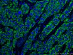SDHB Antibody in Immunohistochemistry (Paraffin) (IHC (P))