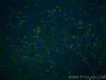 CD63 Antibody in Immunohistochemistry (Paraffin) (IHC (P))