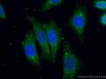 Ch-TOG Antibody in Immunocytochemistry (ICC/IF)