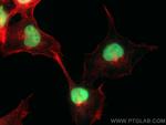 ANP32A Antibody in Immunocytochemistry (ICC/IF)