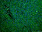 DLD Antibody in Immunohistochemistry (Paraffin) (IHC (P))