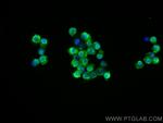 ITK Antibody in Immunocytochemistry (ICC/IF)