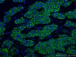ACADM Antibody in Immunohistochemistry (Paraffin) (IHC (P))