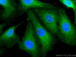 VASH2 Antibody in Immunocytochemistry (ICC/IF)