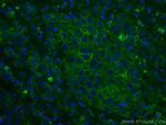 ALCAM Antibody in Immunohistochemistry (Paraffin) (IHC (P))