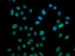 Phospho-mTOR (Ser2448) Antibody in Immunocytochemistry (ICC/IF)