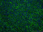 NT5E, CD73 Antibody in Immunohistochemistry (Paraffin) (IHC (P))
