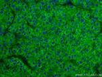 SERBP1 Antibody in Immunohistochemistry (Paraffin) (IHC (P))