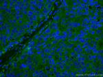DAPK1 Antibody in Immunohistochemistry (Paraffin) (IHC (P))