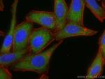 HGS Antibody in Immunocytochemistry (ICC/IF)