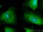 RCHY1 Antibody in Immunocytochemistry (ICC/IF)