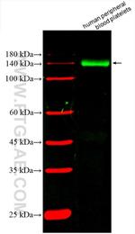 GP1BA Antibody in Western Blot (WB)