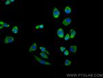 PTPN9 Antibody in Immunocytochemistry (ICC/IF)