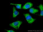 PTPN9 Antibody in Immunocytochemistry (ICC/IF)