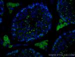TEX14 Antibody in Immunohistochemistry (Paraffin) (IHC (P))