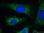 C1QBP Antibody in Immunocytochemistry (ICC/IF)