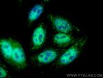 P53 Antibody in Immunocytochemistry (ICC/IF)