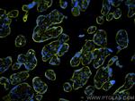 VISTA Antibody in Immunohistochemistry (Paraffin) (IHC (P))