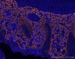 TIM3 Antibody in Immunohistochemistry (Paraffin) (IHC (P))