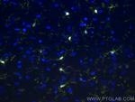 IBA1 Antibody in Immunohistochemistry (Paraffin) (IHC (P))