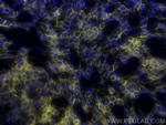 NCAM1/CD56 Antibody in Immunocytochemistry (ICC/IF)