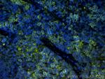 TIGIT Antibody in Immunohistochemistry (Paraffin) (IHC (P))