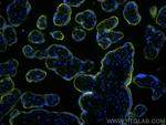 VISTA Antibody in Immunohistochemistry (Paraffin) (IHC (P))