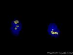 B23/NPM1 Antibody in Immunocytochemistry (ICC/IF)