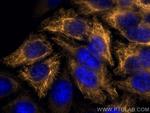 Cytokeratin 14 Antibody in Immunocytochemistry (ICC/IF)