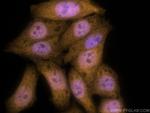 TIA1 Antibody in Immunocytochemistry (ICC/IF)