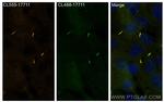 ARL13B Antibody in Immunocytochemistry (ICC/IF)