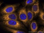 calreticulin Antibody in Immunocytochemistry (ICC/IF)