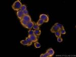 Chromogranin A Antibody in Immunocytochemistry (ICC/IF)