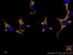 Chromogranin A Antibody in Immunocytochemistry (ICC/IF)