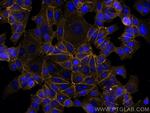 E-cadherin Antibody in Immunocytochemistry (ICC/IF)