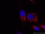 CD107a/LAMP1 Antibody in Immunocytochemistry (ICC/IF)