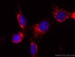 CD107a/LAMP1 Antibody in Immunocytochemistry (ICC/IF)