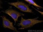 CDK6 Antibody in Immunocytochemistry (ICC/IF)
